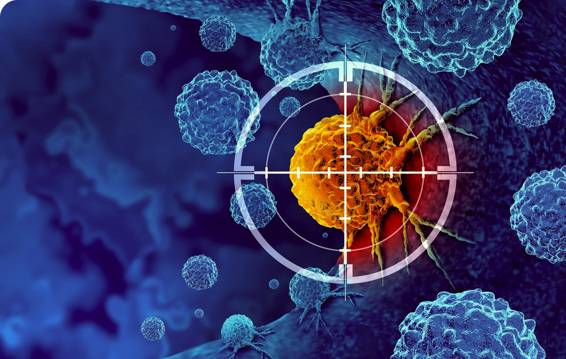 5 Major Cancer Prevention Image